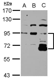 Polyclonal Rabbit anti-Human DIS3L2 Antibody (Internal, IHC, WB)