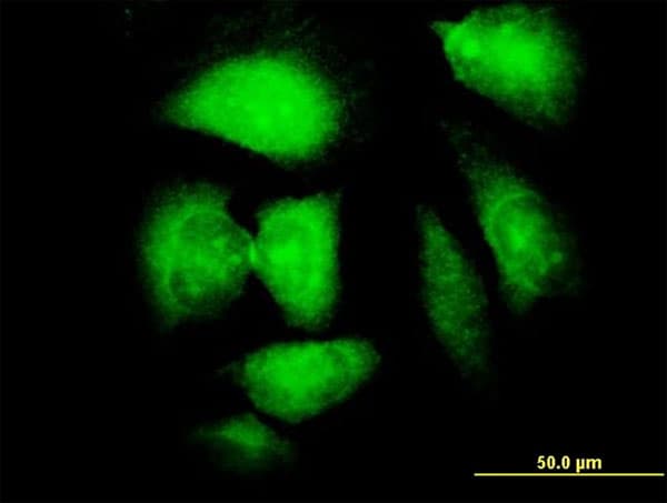 IHC-plus™ Monoclonal Mouse anti-Human NDN / Necdin Antibody (clone 1B3, IHC, IF, WB)