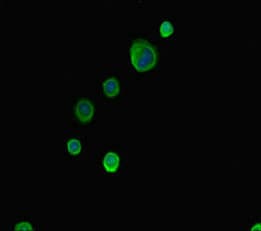 Polyclonal Rabbit anti-Human ABCG8 Antibody (IHC, IF, WB)