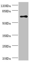 Polyclonal Rabbit anti-Human RNGTT / HCAP Antibody (IHC, WB)