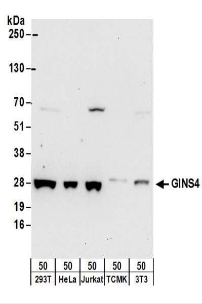 Polyclonal Rabbit anti-Human GINS4 / SLD5 Antibody (aa173-23, WB)
