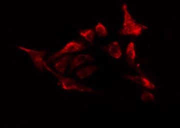 OXSR1 / OSR1 Antibody (phospho-Thr185)