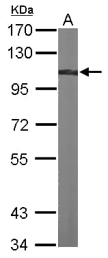 ACTN4 Antibody (aa206-542)