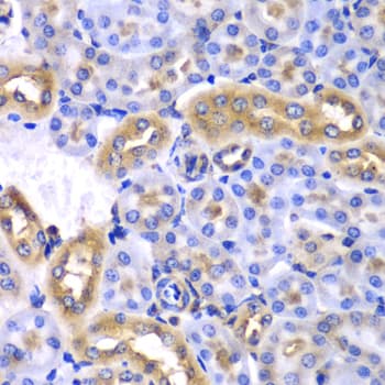 SYNCRIP / HnRNP Q Antibody