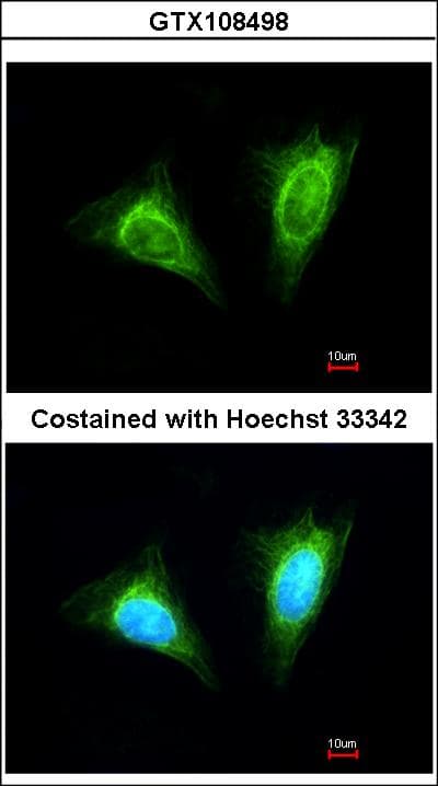 KLRC1 / NKG2A / CD159a Antibody (aa1-45)