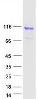 Human COMP / THBS5 Protein (Recombinant Myc-DDK (Flag))