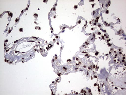 Monoclonal Mouse anti-Human HNRNPL / hnRNP L Antibody (clone OTI9G7, aa270-502, IHC, WB)