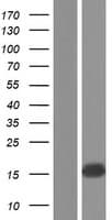 SCP2 / SCPX Protein (Over-Expression Lysate Myc-DDK (Flag))