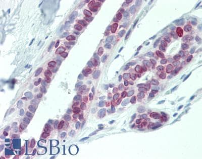 IHC-plus™ Polyclonal Rabbit anti-Human DHRS4L2 Antibody (aa132-158, IHC, WB)
