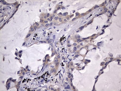 KYNU Antibody (aa1-216, clone OTI1H1)