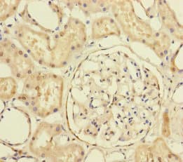 Polyclonal Rabbit anti-Human PRPF4 Antibody (IHC, WB)