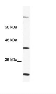 Polyclonal Rabbit anti-Human FGD1 Antibody (C-Terminus, IHC, WB)