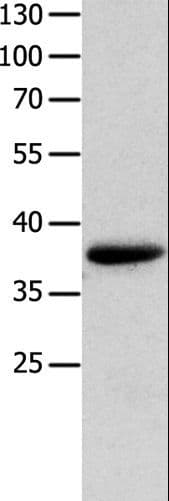 Myozenin / MYOZ1 Antibody