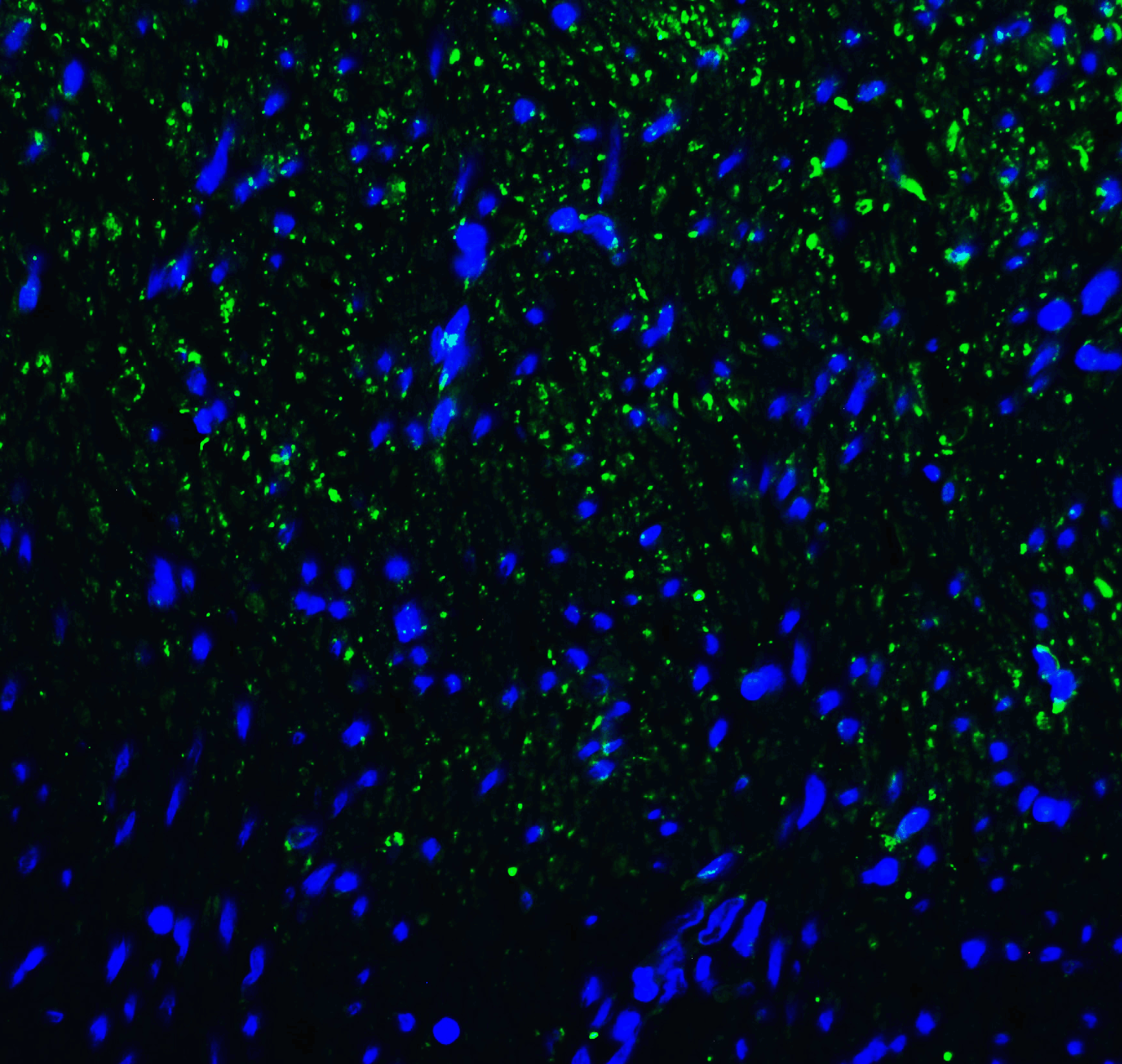 HAVCR2 / TIM-3 Antibody (clone 3G7)