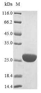 Vesicular Stomatitis Virus VSIV L Protein (Recombinant 6His, N-terminus)