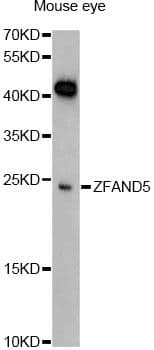 Polyclonal Rabbit anti-Human ZFAND5 Antibody (WB)