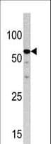 NCAPH2 / CAP-H2 Antibody (aa198-227)