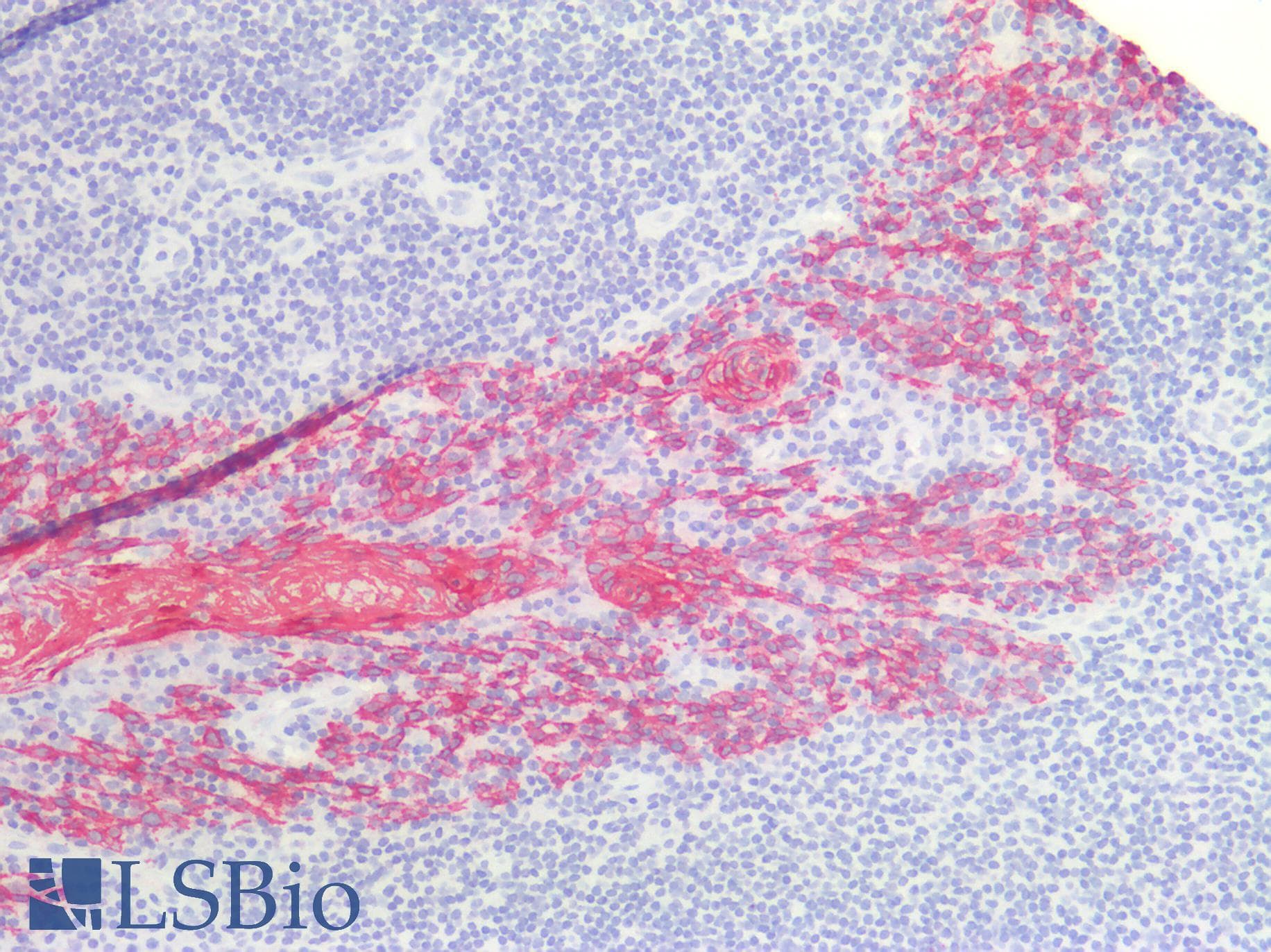 PathPlus™ KRT17 / CK17 / Cytokeratin 17 Antibody
