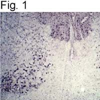park / Parkin Antibody (Amino Acid: 298-313)