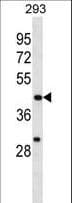 EGLN1 / PHD2 Antibody (aa396-425)
