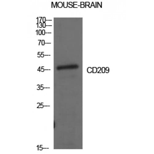CD209 / DC-SIGN Antibody (261-310 aa, Internal)