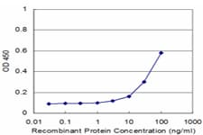 RFXAP Antibody (clone 1B5)
