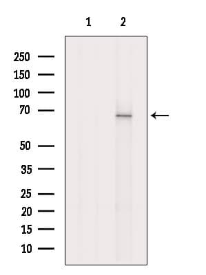 Polyclonal Rabbit anti-Human CBFA2T3 Antibody (IF, WB)