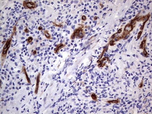 MCAM / CD146 Antibody (clone UMAB155)
