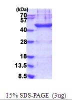 Human LP-PLA2 / PLA2G7 Protein (Recombinant His)