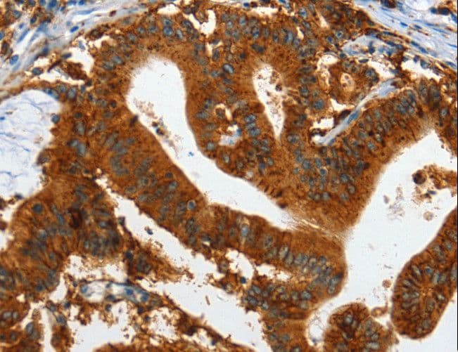 Polyclonal Rabbit anti-Human IL20RA Antibody (IHC)