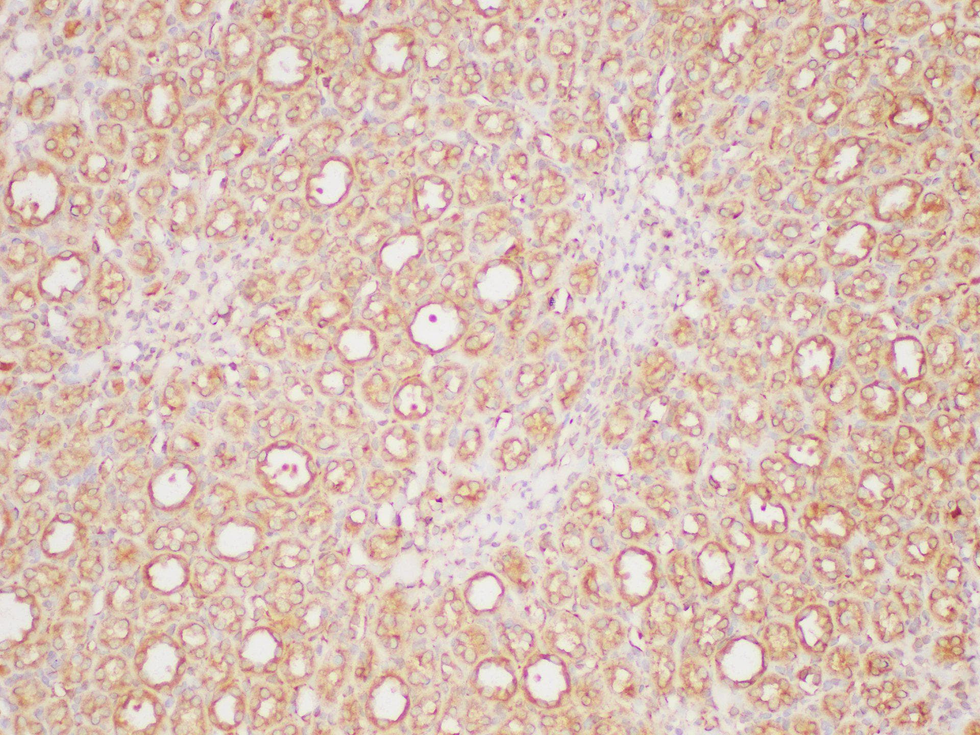 Polyclonal Rabbit anti-Human PAIP1 Antibody (IHC)