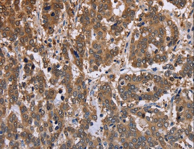 Polyclonal Rabbit anti-Human FBP2 Antibody (IHC)