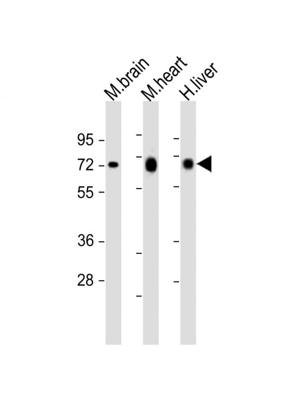 Polyclonal Rabbit anti-Human PGM1 / Phosphoglucomutase 1 Antibody (aa469-501, IHC, WB)