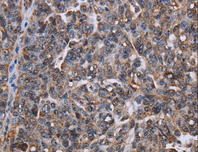 LDOC1 Antibody