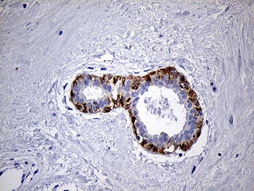 LAD1 Antibody (aa271-517, clone OTI7H8)