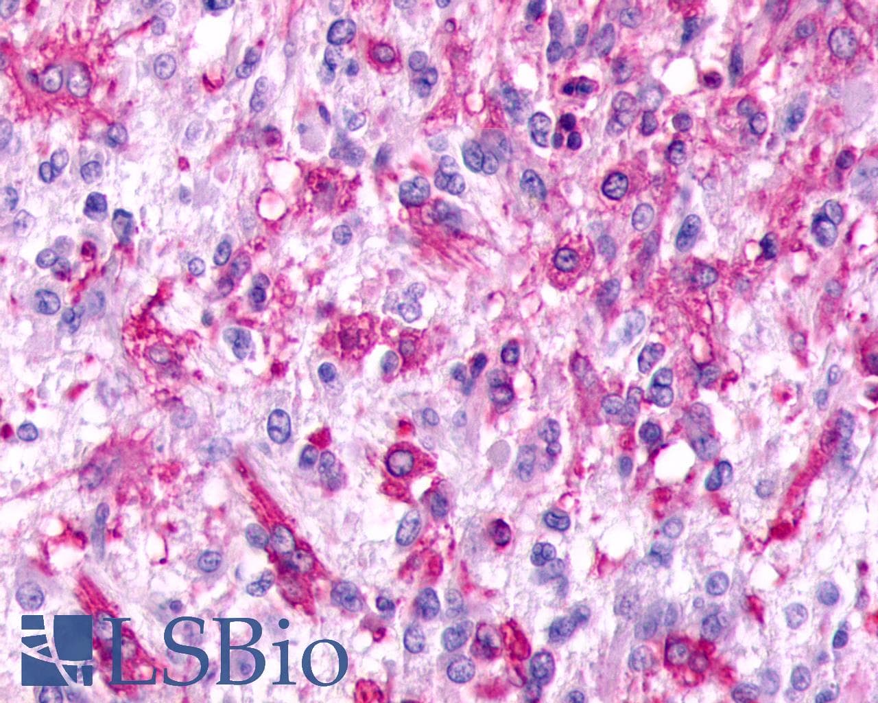 PathPlus™ GPR17 Antibody (Cytoplasmic Domain)
