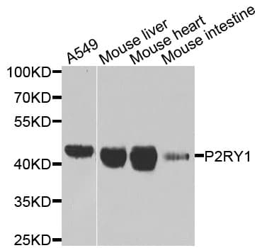 Polyclonal Rabbit anti-Human P2RY1 / P2Y1 Antibody (IHC, WB)