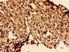 GLRA1/Glycine Receptor Alpha 1 Antibody