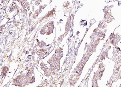 Polyclonal Rabbit anti-Human BAD Antibody (phospho-Ser155, IHC, IF, WB)