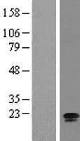 RSL24D1 Protein (Over-Expression Lysate Myc-DDK (Flag))