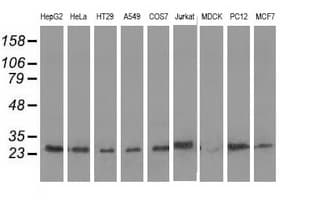 AK3 / Adenylate Kinase 3 Antibody (clone OTI6D6)