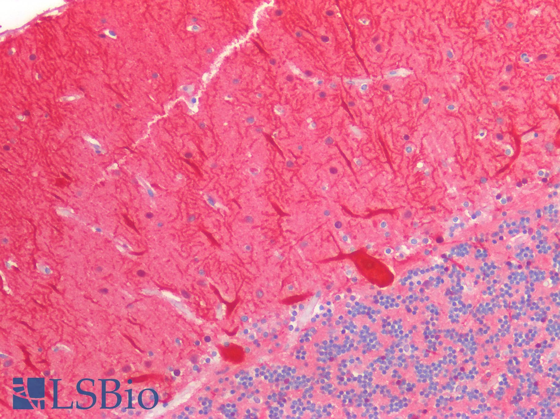 PathPlus™ CALB1 / Calbindin Antibody (aa3-261)