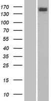 ERCC6 / CSB Protein (Over-Expression Lysate Myc-DDK (Flag))