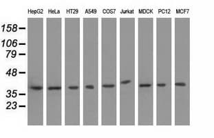 Monoclonal Mouse anti-Human HIBCH Antibody (clone OTI3D11, IF, WB)