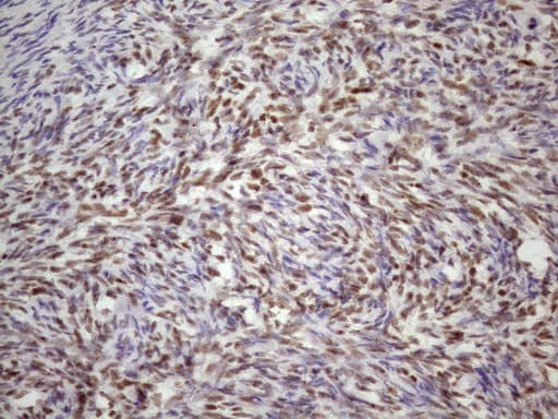 TP53BP1 / 53BP1 Antibody (aa1-300, clone OTI2H6)