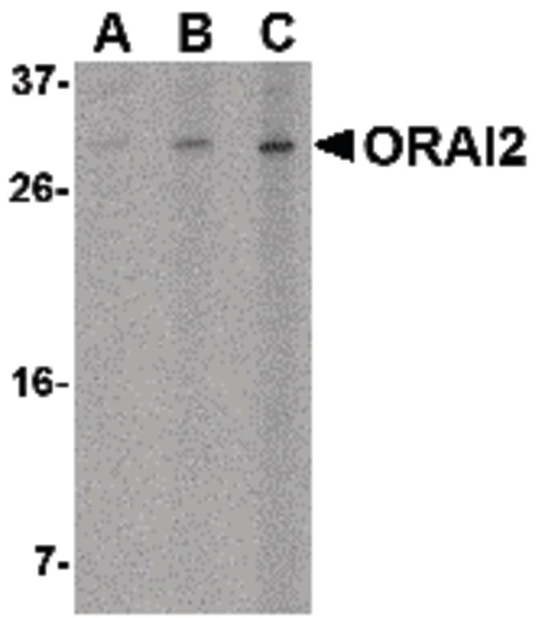 IHC-plus™ ORAI2 Antibody