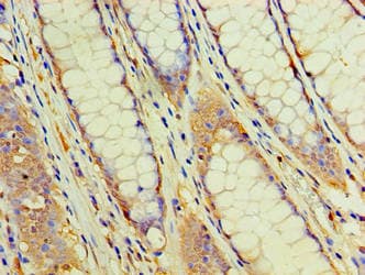 EHHADH / Enoyl-Coa Hydratase Antibody (aa1-723)