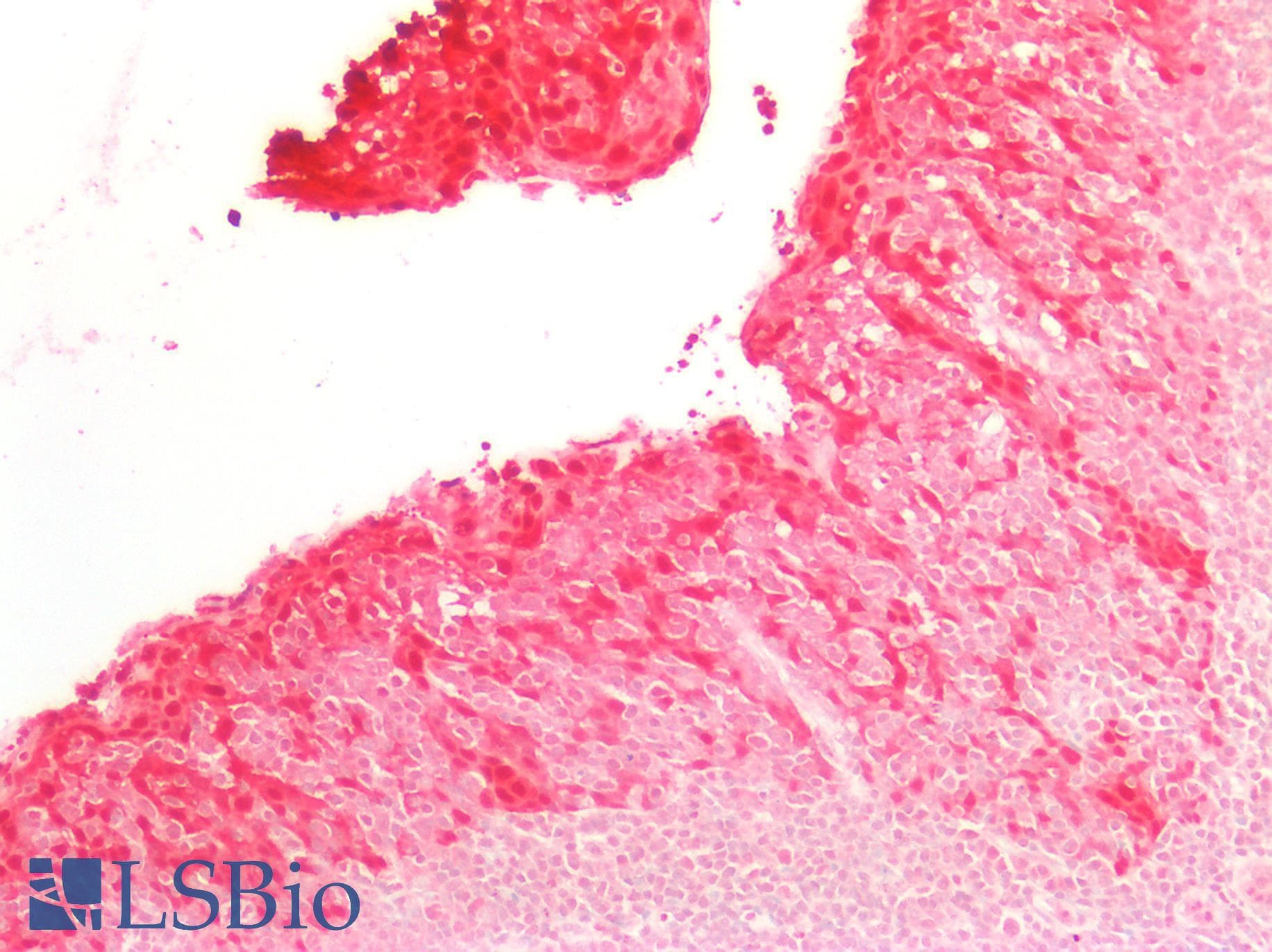 PathPlus™ SERPINB5 / Maspin Antibody