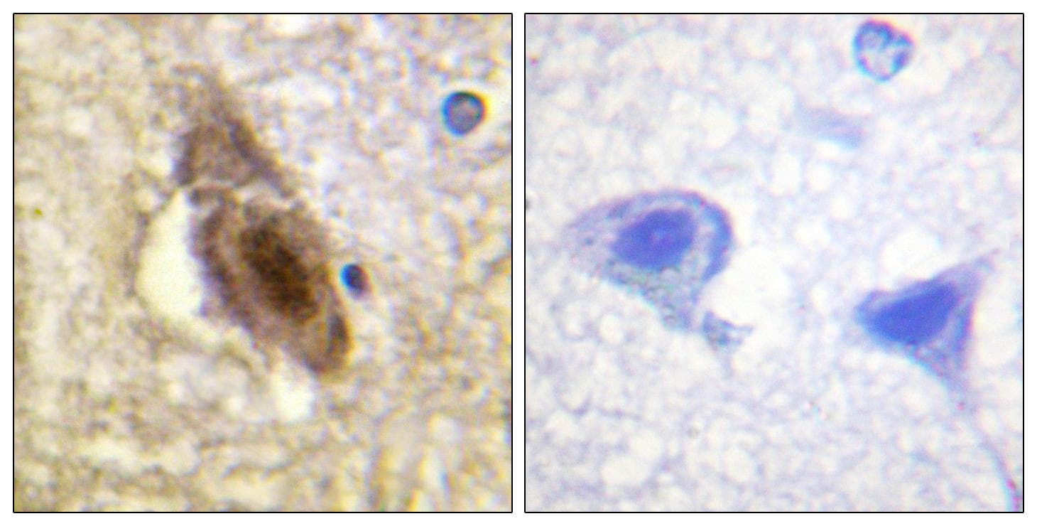 SSB / La Antibody (phospho-Ser366)