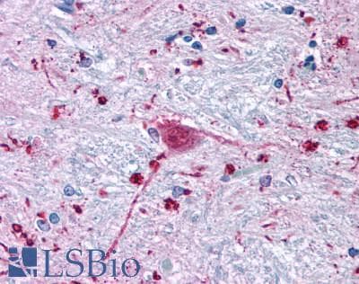 PathPlus™ Polyclonal Rabbit anti-Human FZD3 / Frizzled 3 Antibody (N-Terminus, IHC)